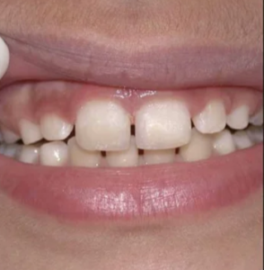 after pediatric dentistry - klinik pergigian dental shore